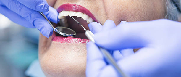 Best Emergency Dental Care for Sports Injuries in Fairplay, GA